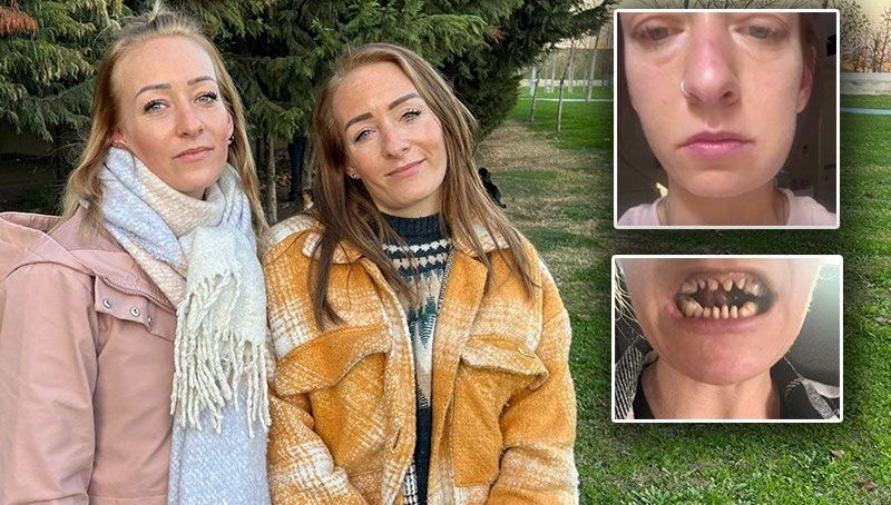 Danimarkalı ikizlerin Türkiye’de diş tedavisi kabusu