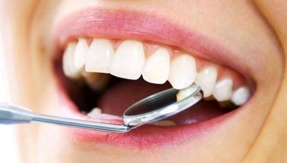 Diş iltihabına ne iyi gelir? Diş iltihabı nasıl geçer? Diş iltihabı neden olur, belirtileri nelerdir?